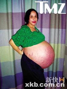 八胞胎妈妈的告白,爱的奇迹与育儿挑战